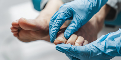 Toenail fungus contagious discount