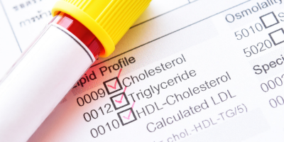 cola lipid c efficacy against albicans Susceptibility of Candida dublini- ensis, C. tropicalis, C. albicans