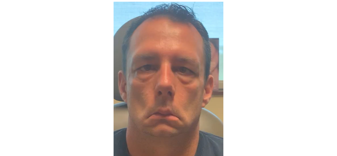 patient facial paralysis before