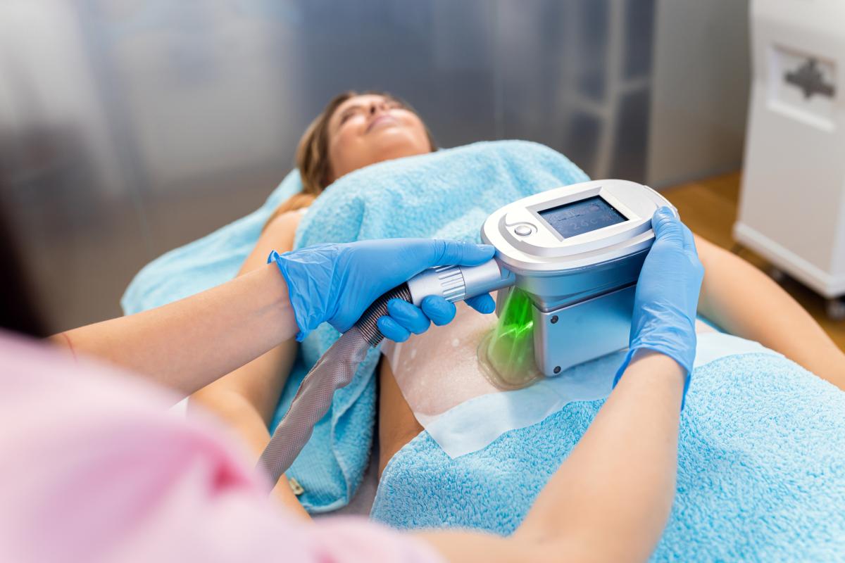 CoolSculpting