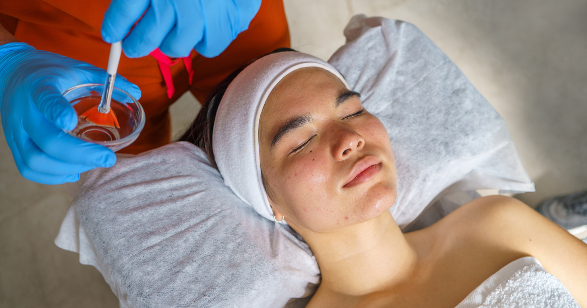 Woman getting chemical peel