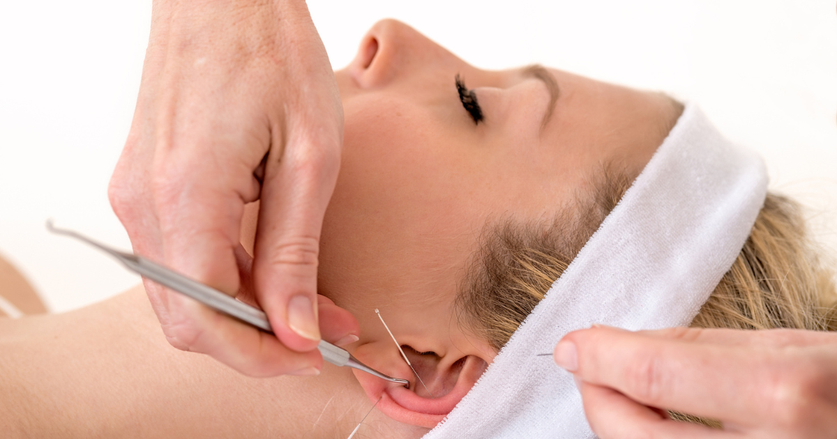 Woman getting acupuncture on ear