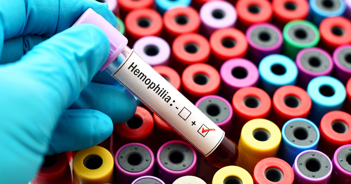 Blood test vial for hemophilia