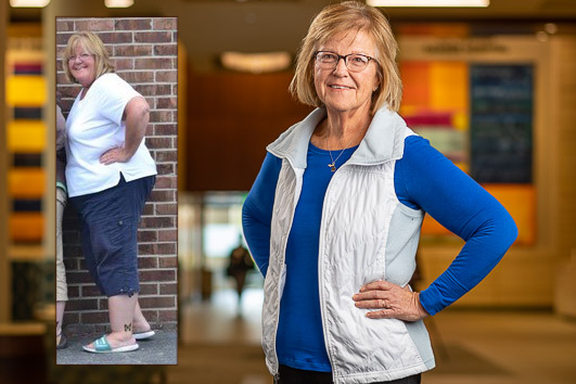 Molly Smith before and after losing over 100 pounds. 