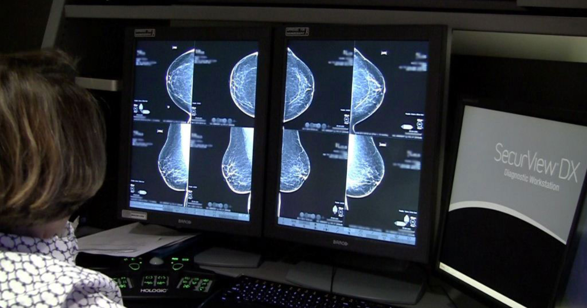 3D mammogram images