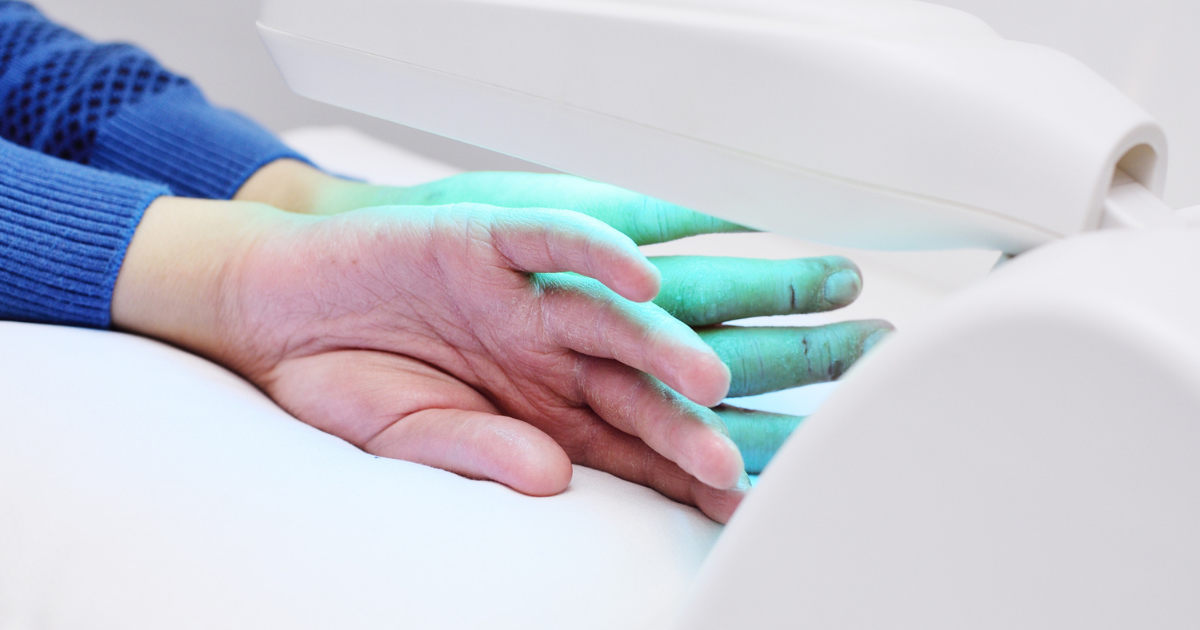 Close up of patient receiving phototherapy on hands