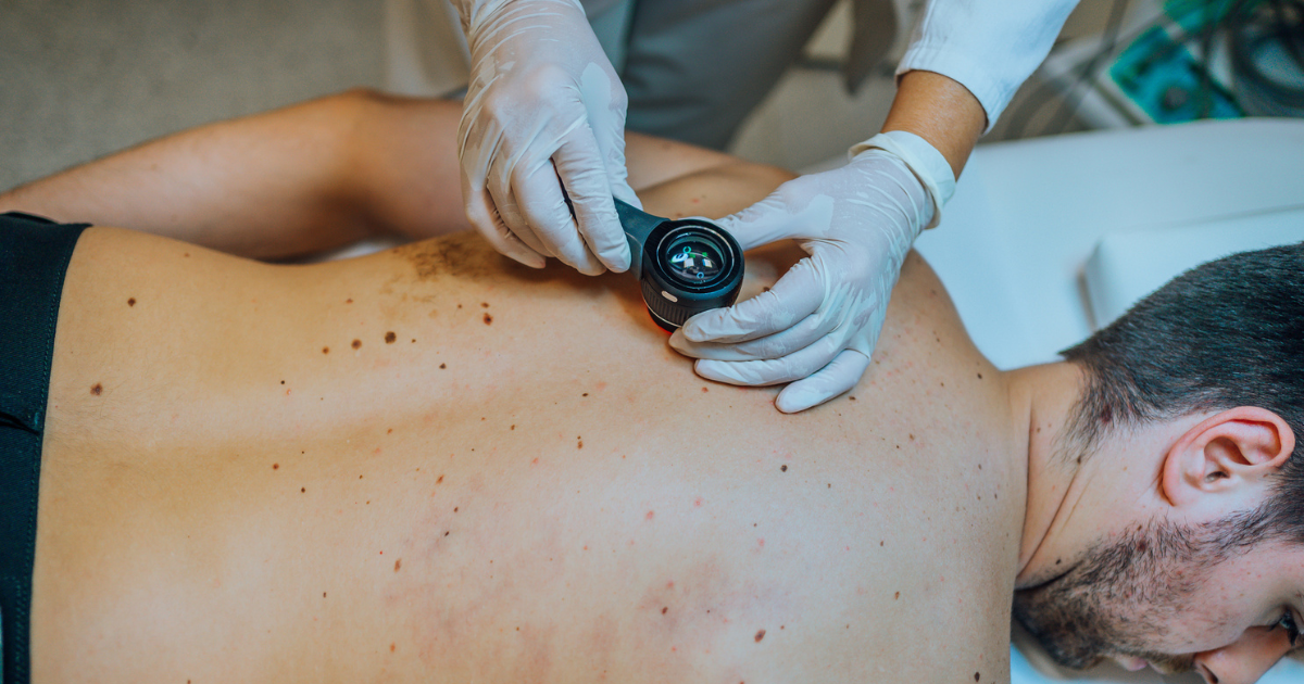Dermatologist inspecting man's back