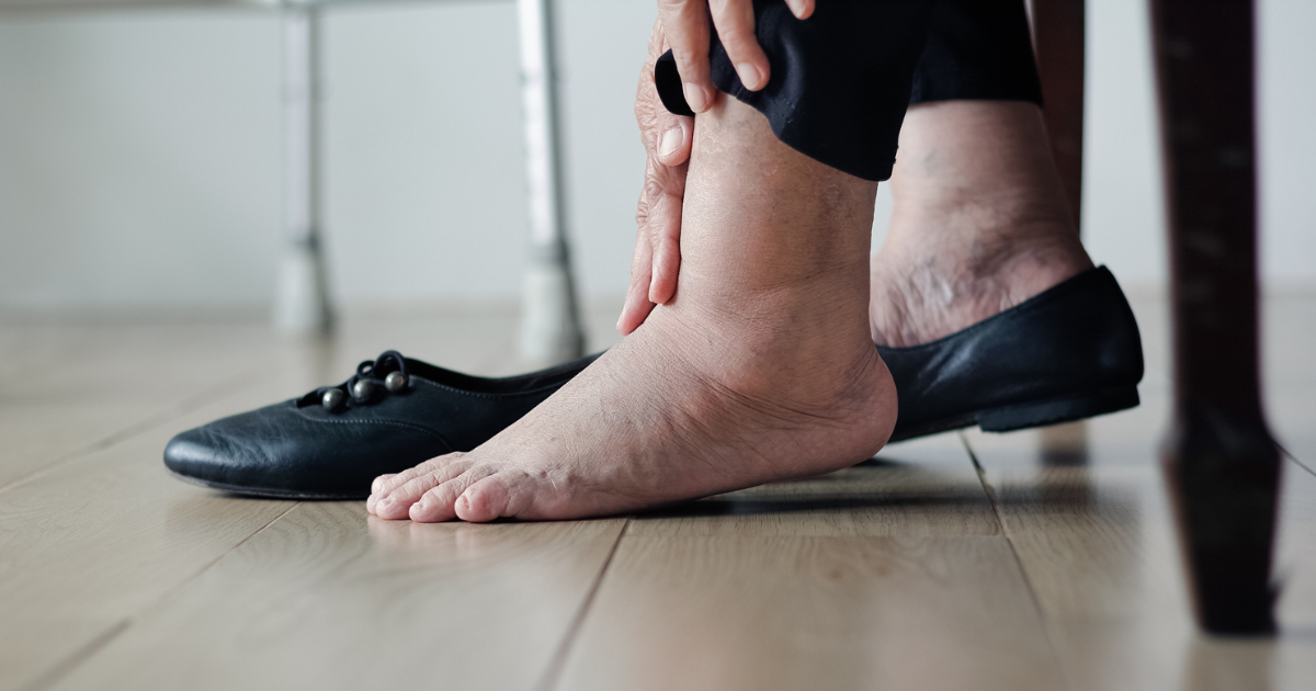 Close up of older woman putting on shoes, holding swollen ankle