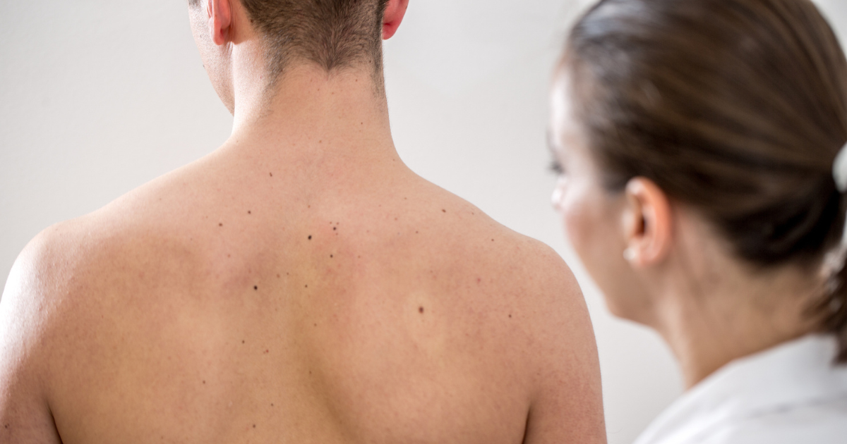 Doctor looking at man's back