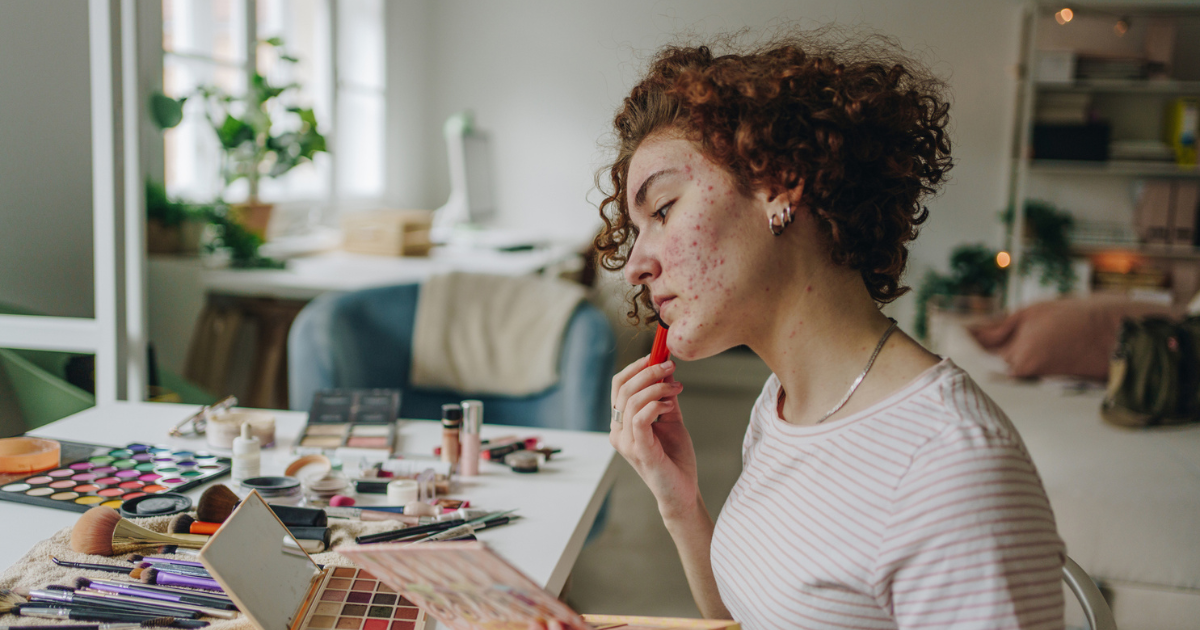 Young woman with acne applying makeup