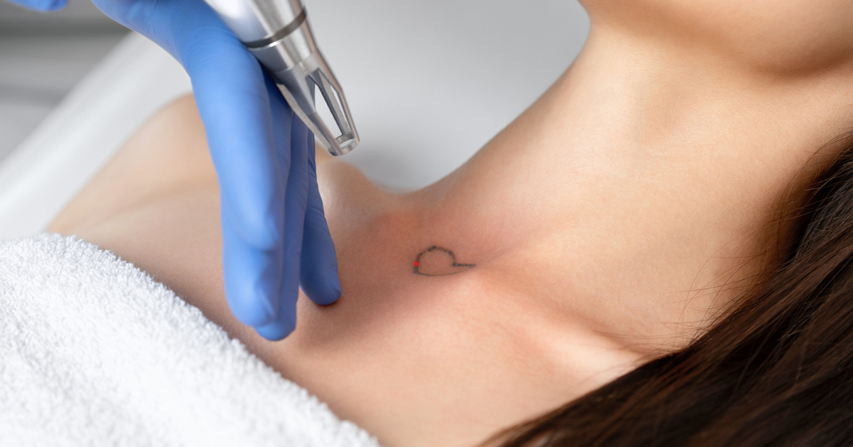 Skinial Treatments Leave Scars  Disappear Laser Clinic  Tattoo Removal