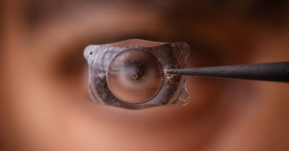 Close up of ICL lens being held in front of person's eye