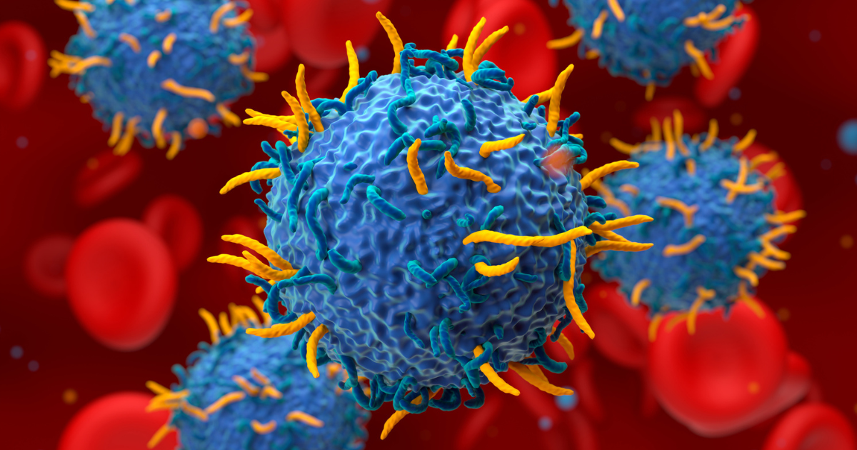 CAR T-cell therapy for stubborn classical hematology issues