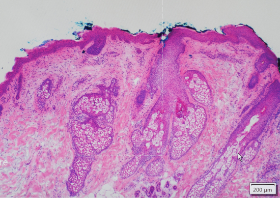 Medical imaging of cells from Mohs surgery.