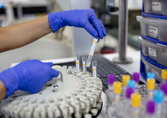 Hematologist looking through samples