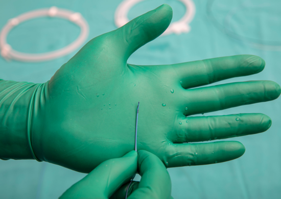 Gloved hand holding microcatheter