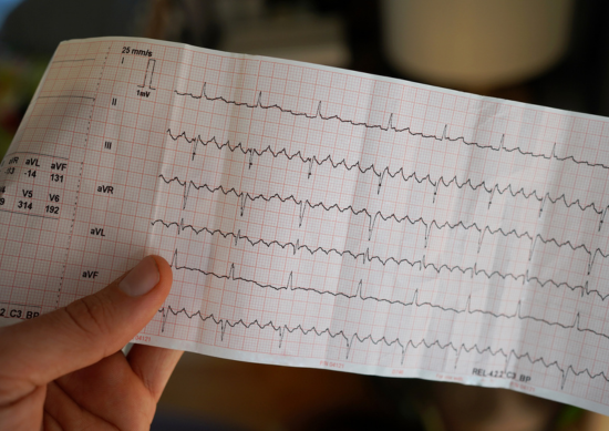 Heart rhythm scan