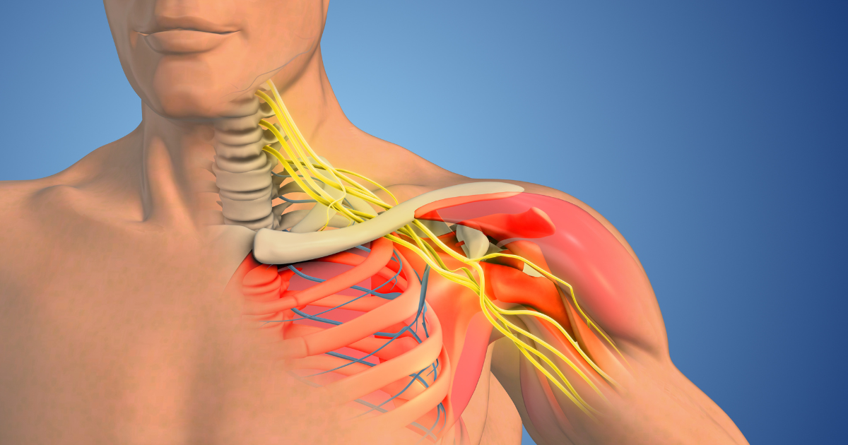 Medical illustration- Brachial plexus nerve network in the shoulder structure