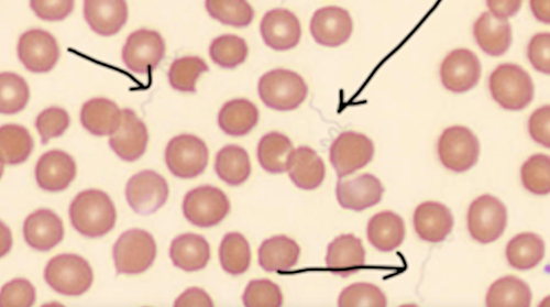 Spiral-shaped bacterium