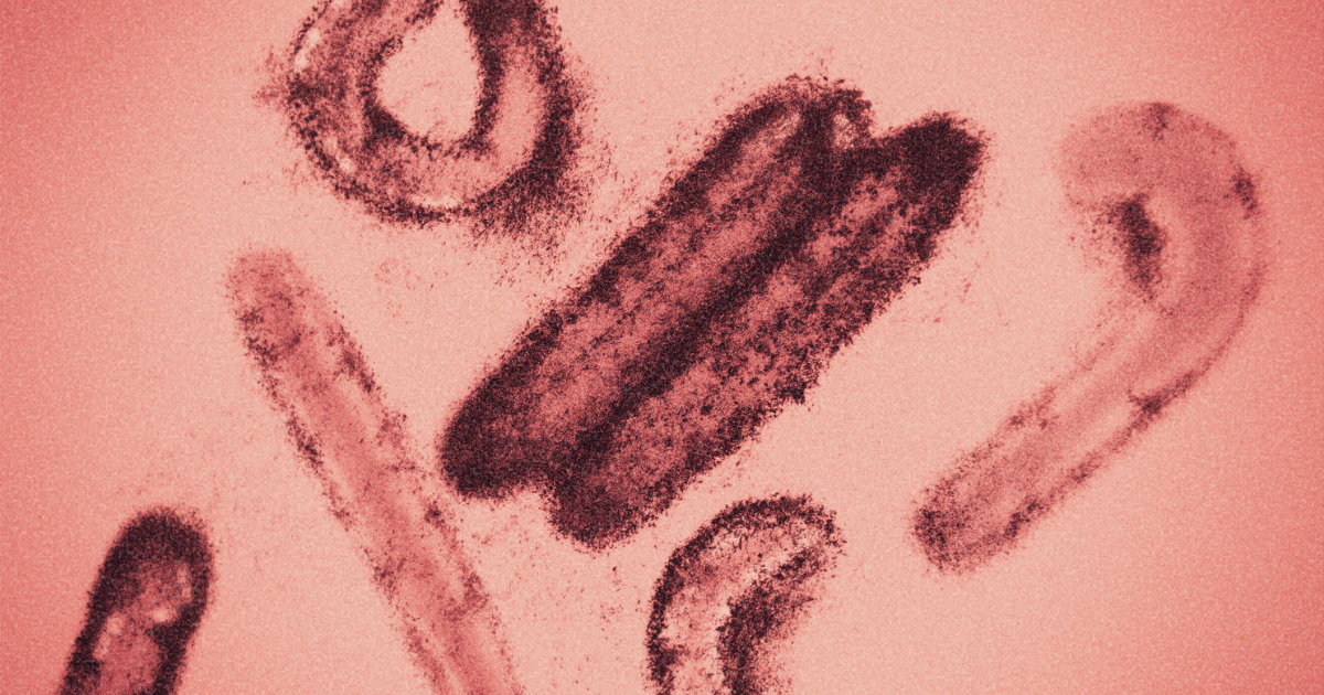 Colored visualization of Marburg virus electron microscopy photo