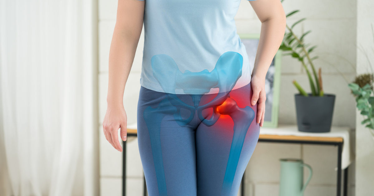 Close up of woman's midsection with overlay of medical illustration of hip joint highlighted in red