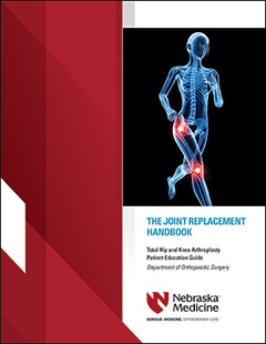 Joint Replacement Handbook Download