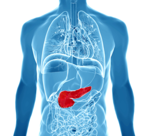 Pancreatic_Cancer_Graphic.png