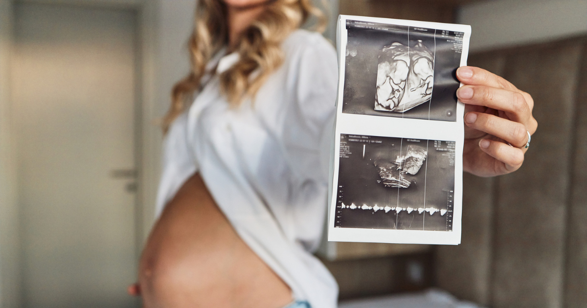 Pregnant woman holding ultrasound photo of her twins