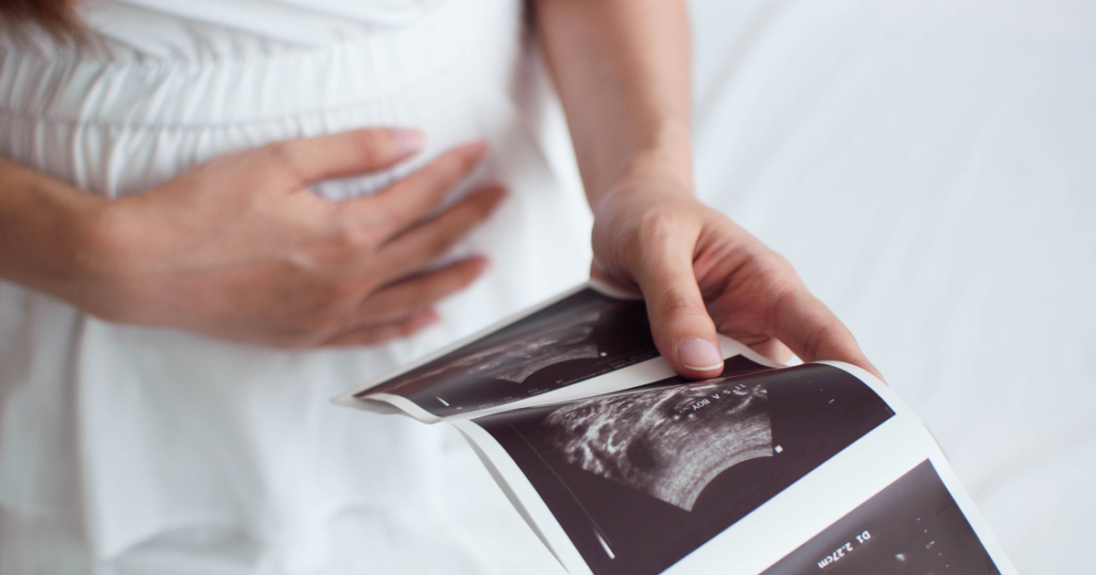 picture of a pregnant woman looking at ultrasound images