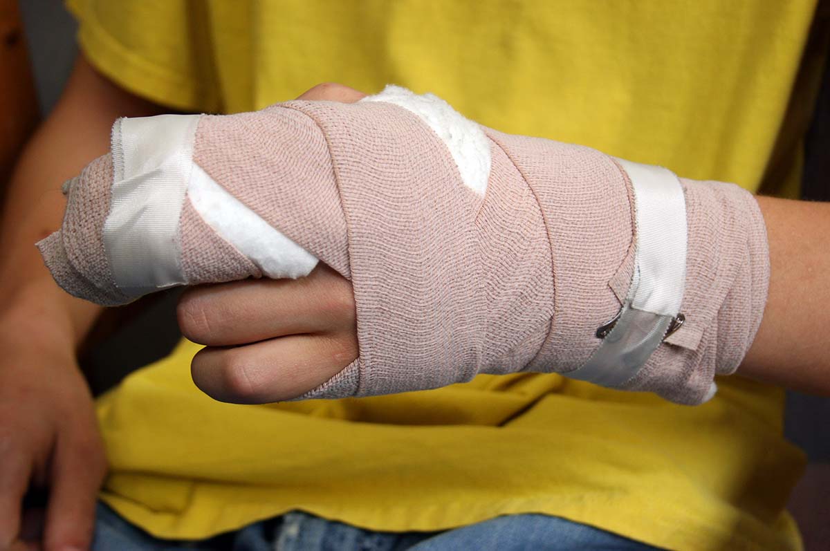 Close up of a hand wrapped in gauze