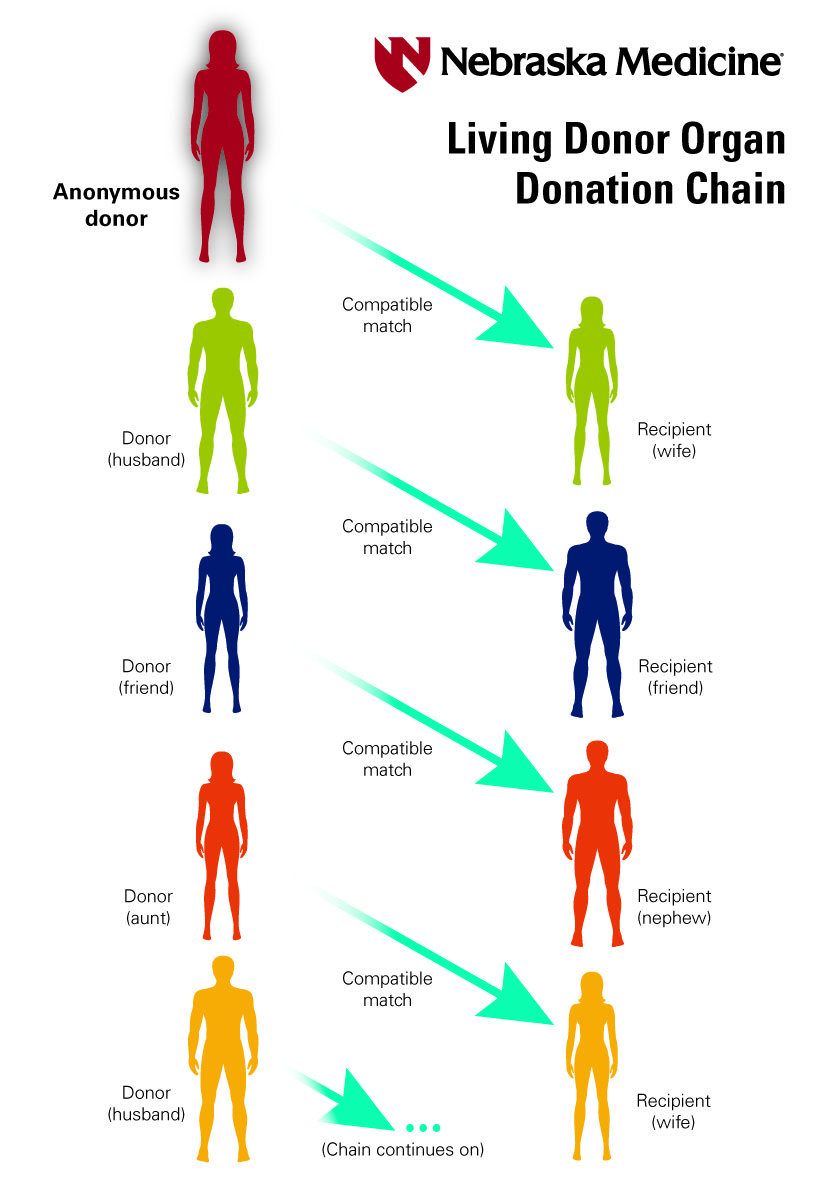 Illustration of how a Living Donor chain works