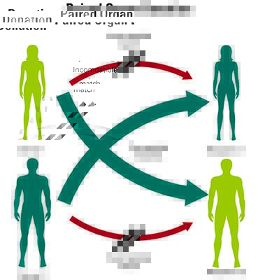 Living Donor Liver Transplant: Requirements, Risks & Recovery