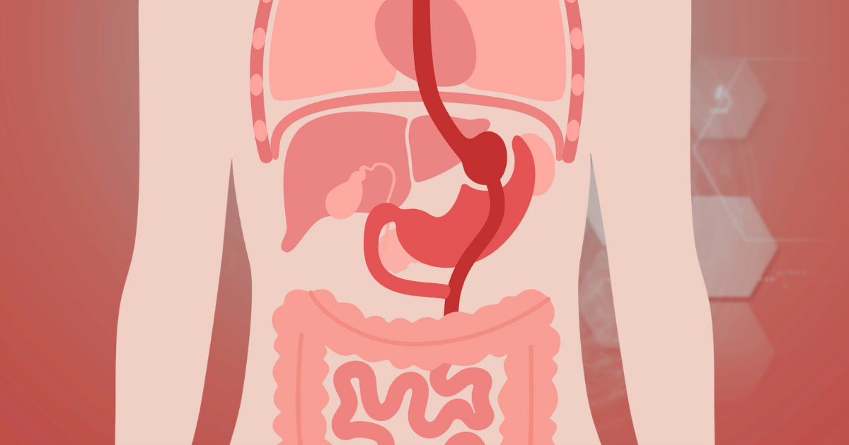 Medical illustration of gastric bypass