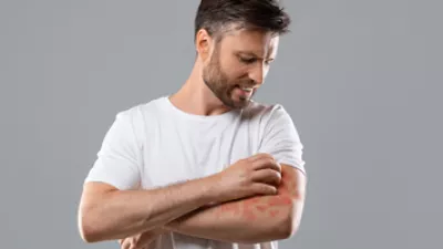picture of a man scratching his arm