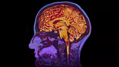 picture of a brain MRI
