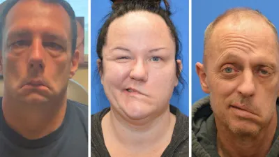 Three facial paralysis patients before surgery