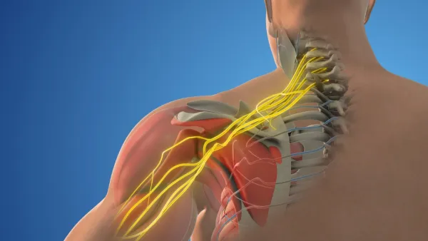 Medical illustration- Brachial plexus nerve network in the shoulder structure