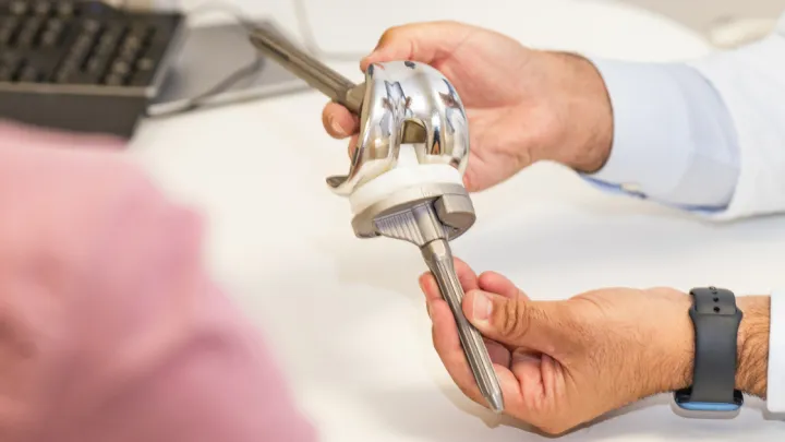 A doctor showing a knee prosthesis to a patient during a medical consultation.
