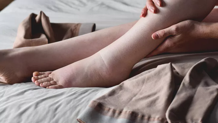 Woman sitting in bed massaging and examining swollen feet