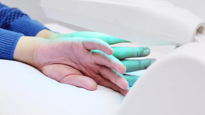 Close up of patient receiving phototherapy on hands