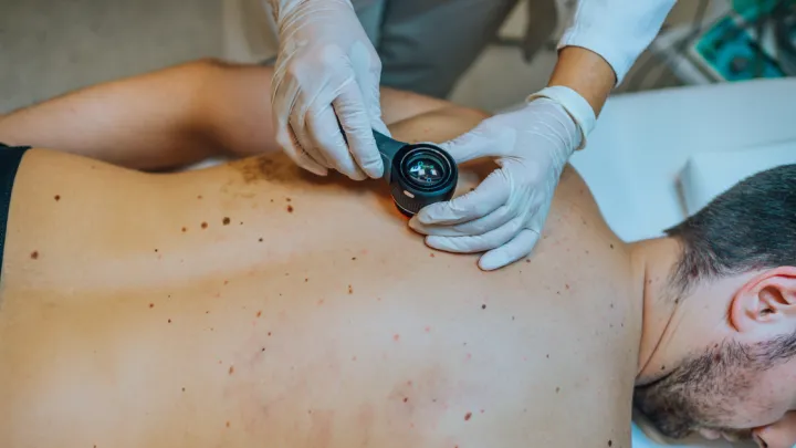 Dermatologist inspecting man's back