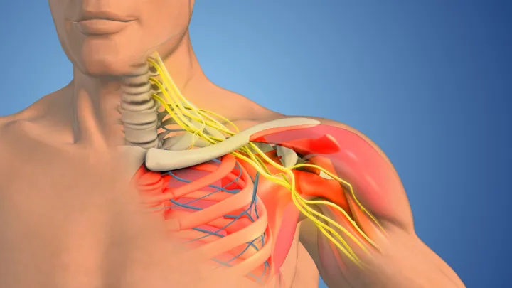 Medical illustration- Brachial plexus nerve network in the shoulder structure