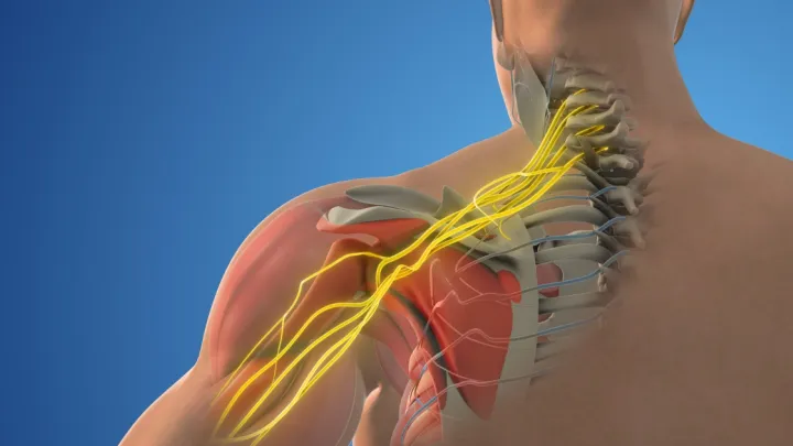 Medical illustration- Brachial plexus nerve network in the shoulder structure
