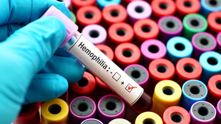 Blood test vial for hemophilia